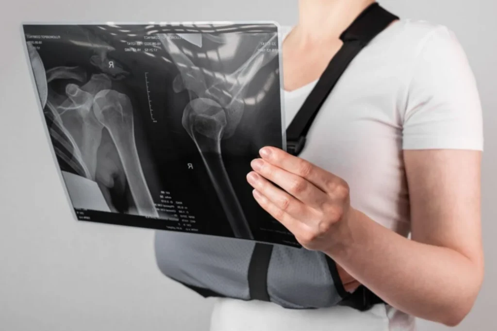 View X-Ray For Shoulder, Woman checking x-ray