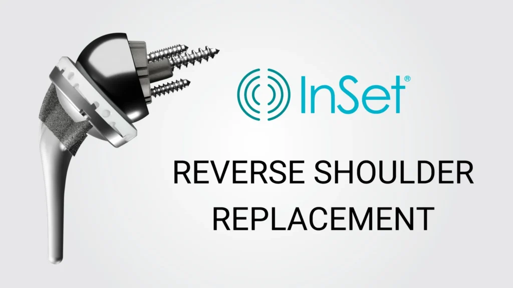 Implant Images RSA Inset® reverse shoulder replacement technology.