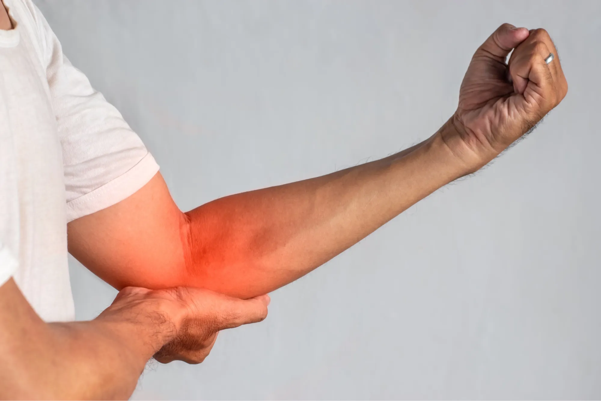 patient elbow with Cubital Tunnel Syndrome